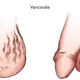 Illustration for article titled Obat Herbal Alami Varikokel